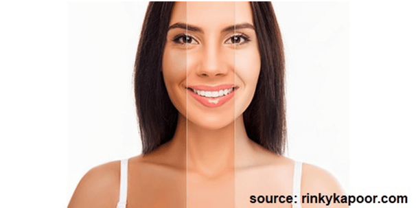 Are Skin Whitening Treatments Safe?